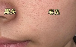 毛孔大黑头困扰，选什么护肤品？