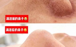 祛痘去黑头，哪个产品更有效？