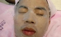 长沙红蓝光祛痘著美莱效果如何？