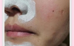 护肤品擦脸后搓泥是咋回事？