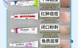 长痘痘能不能用护肤品