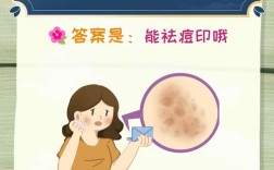 激光祛痘去痘印效果如何？