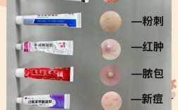 先用补水还是祛痘产品？