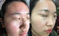 祛痘产品致脸毁容，该找谁负责？