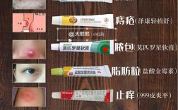 999王妃祛痘多少钱