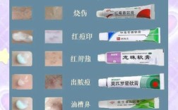 祛痘膏含激素怎么辨别？