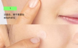 净痘贴真能快速祛痘吗？