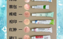 长痘了到底能不能用祛痘产品？