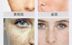 哪些护肤品用后反而会致长斑？