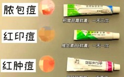 苦杏仁敷脸祛痘靠谱吗？