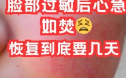 什么护肤品适合温和舒缓脸部过敏肌肤？