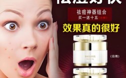 擦什么能祛痘痘印？