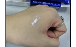 日本男士祛痘个牌子好