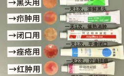 酸奶涂脸能祛痘吗？