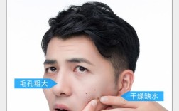什么祛痘最快最有效男