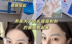 长痘该补水还是祛痘面膜？