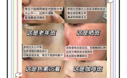 祛斑祛痘，哪种方法最有效？