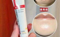 祛痘达人面膜真的好用吗？