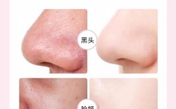 去黑头收缩毛孔，护肤品真的有效吗？