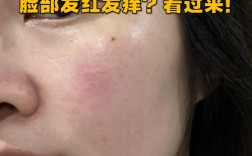 护肤品过敏脸痒肿，急救方法有哪些？