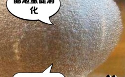 白醋泡鸡蛋真能祛痘吗？