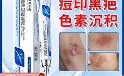 祛痘疤手术费用受哪些因素影响？