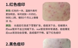 如何有效祛除红黑痘印？