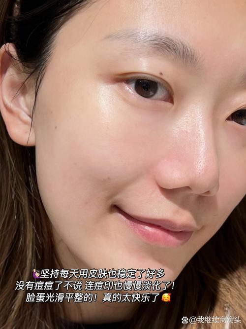 新升级XX护肤品，真的有效吗？适合我的肤质用吗？-图3