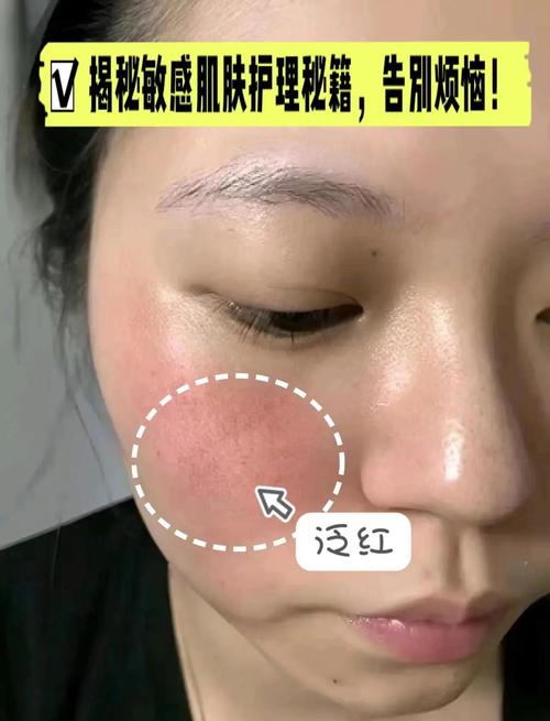 什么护肤品适合温和舒缓脸部过敏肌肤？-图3