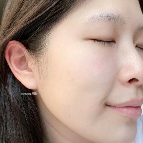 泰国boots expert祛痘效果到底怎么样？-图2