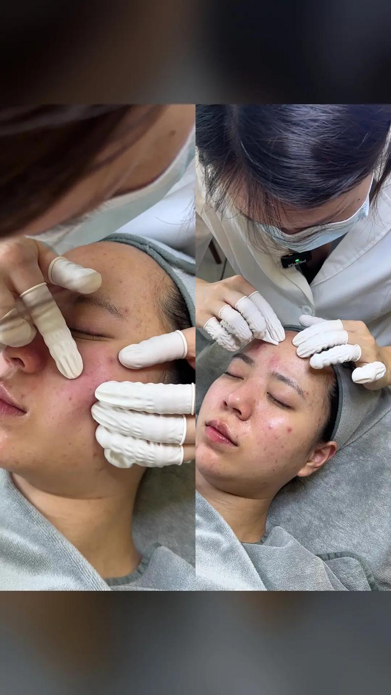 Lisa Eldridge祛痘真有效吗？-图1