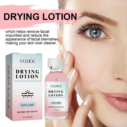 drying lotion祛痘真的有效吗？-图1