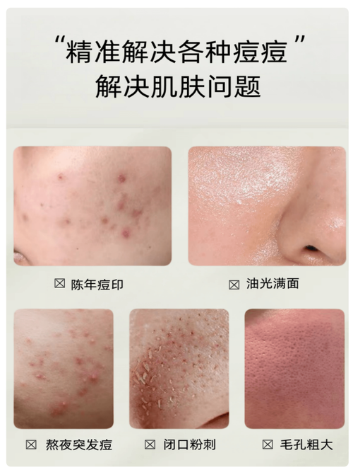 boscia祛痘修复液正确用法是什么？-图3