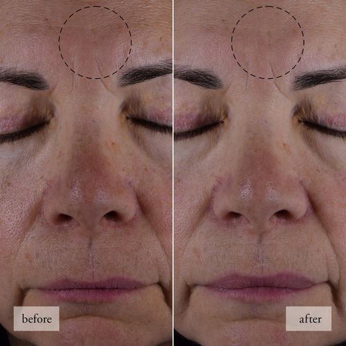 Philosophy护肤品真的适合所有肤质吗？-图3