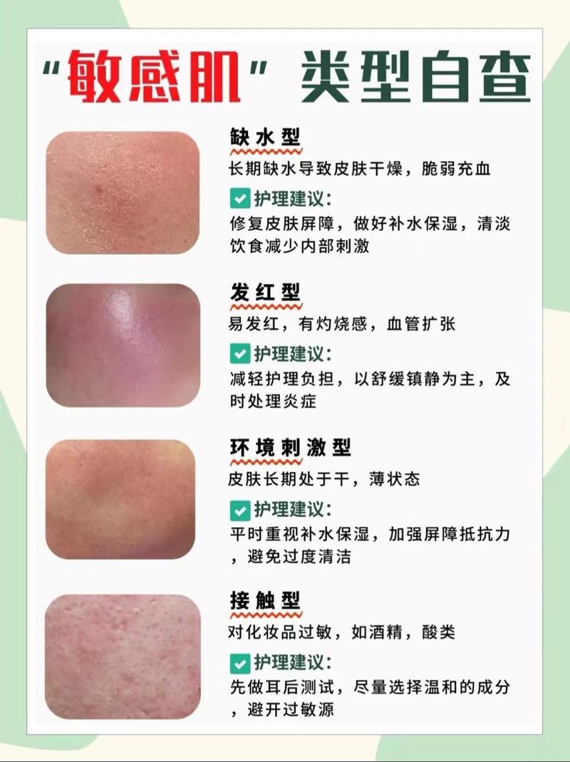 肌肤用啥护肤品都过敏，咋办？-图1