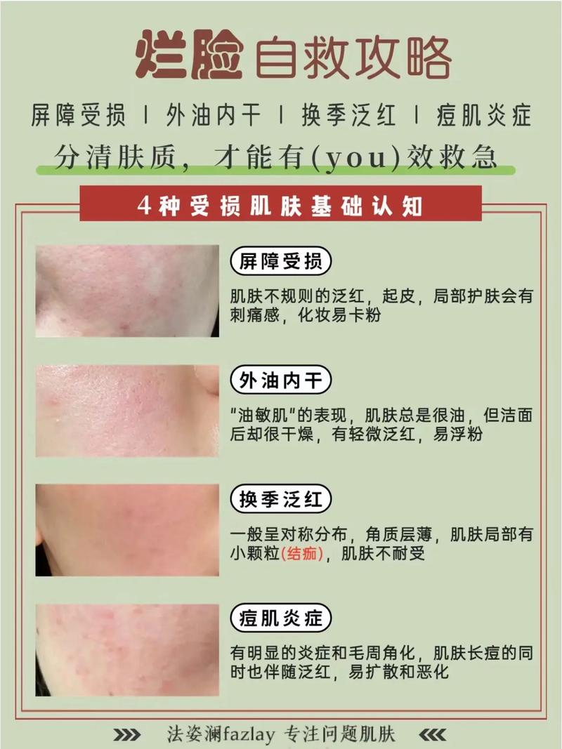 护肤品过敏脸红痒，咋快速缓解？-图3