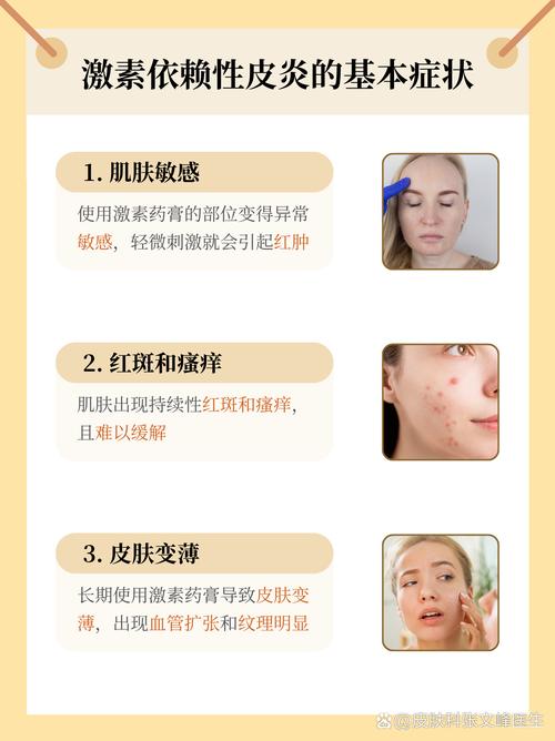 激素护肤品用了会怎样？-图2