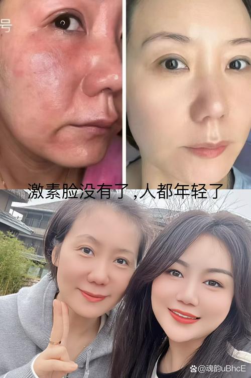 激素护肤品用了会怎样？-图3