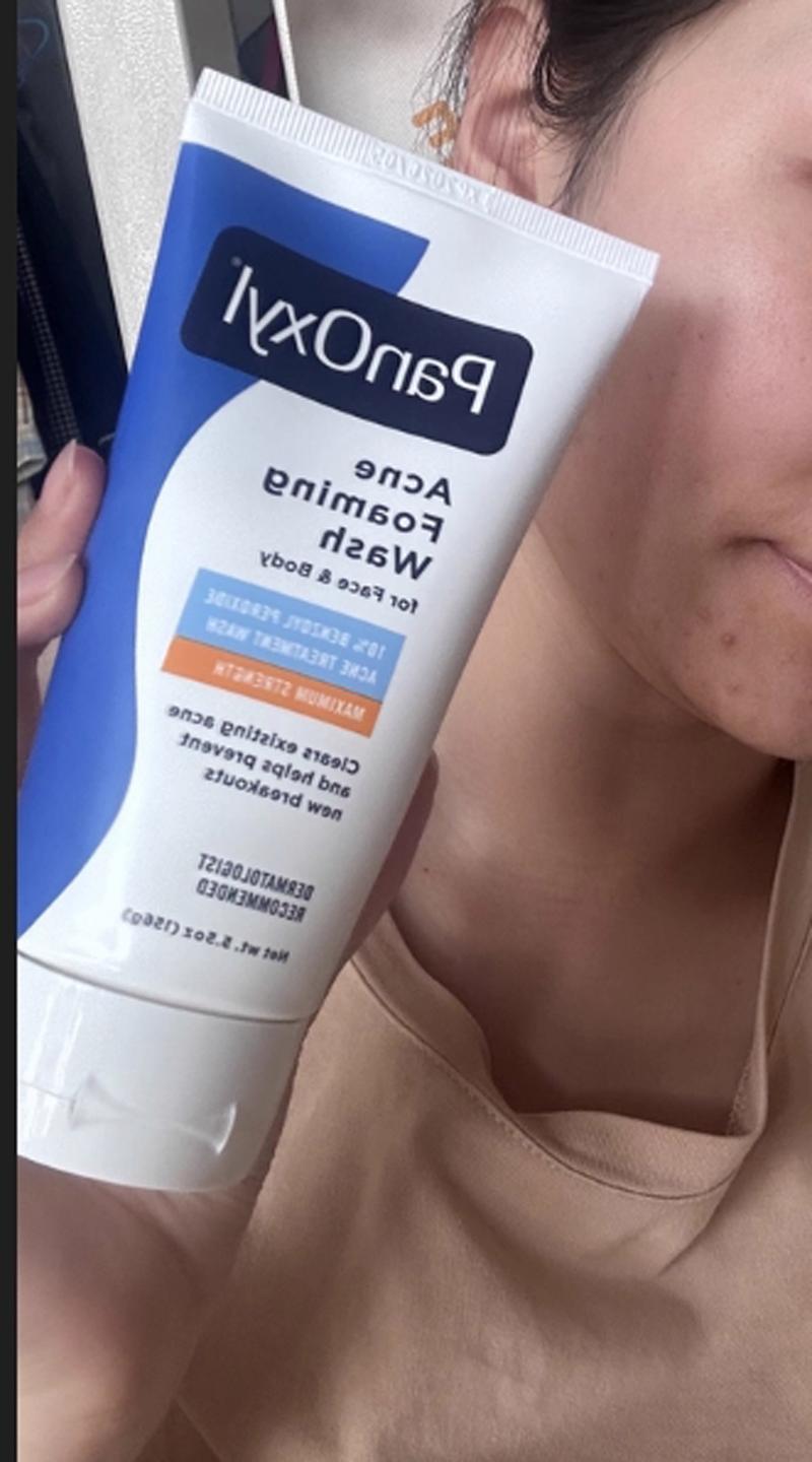 17岁女孩护肤品怎么选？基础保湿还是功效型？-图2