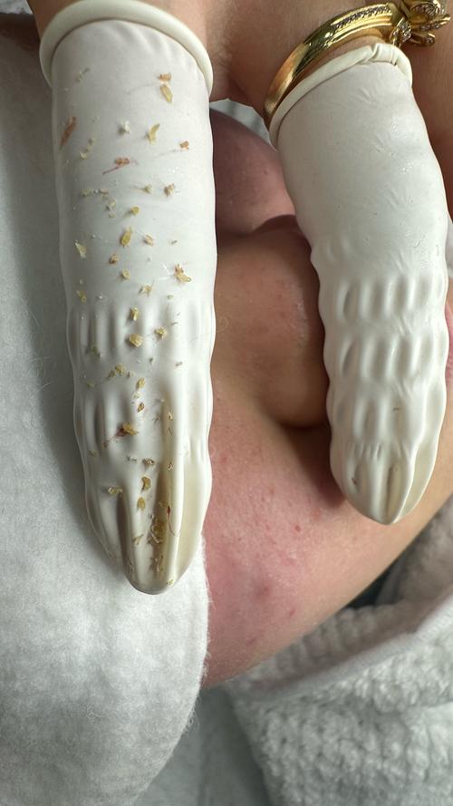 泰国anti acne祛痘真的有效吗？-图2