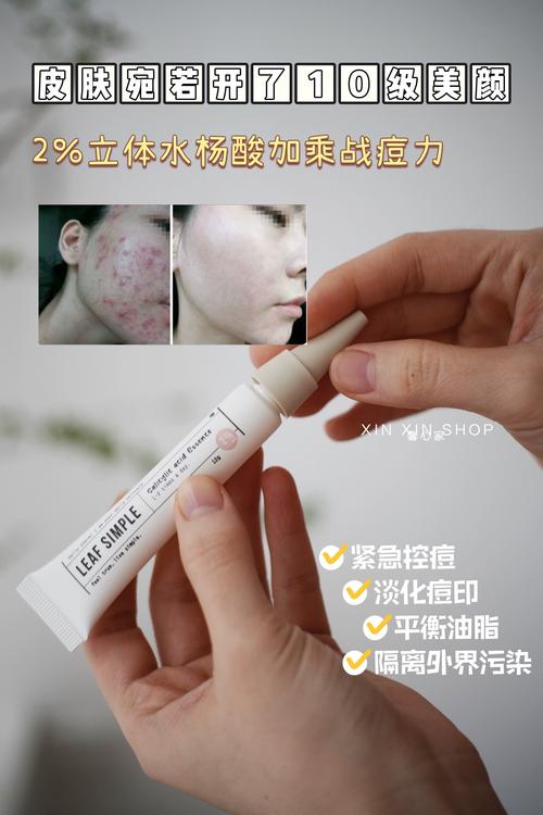 simple祛痘美白糖怎么用才有效？-图2