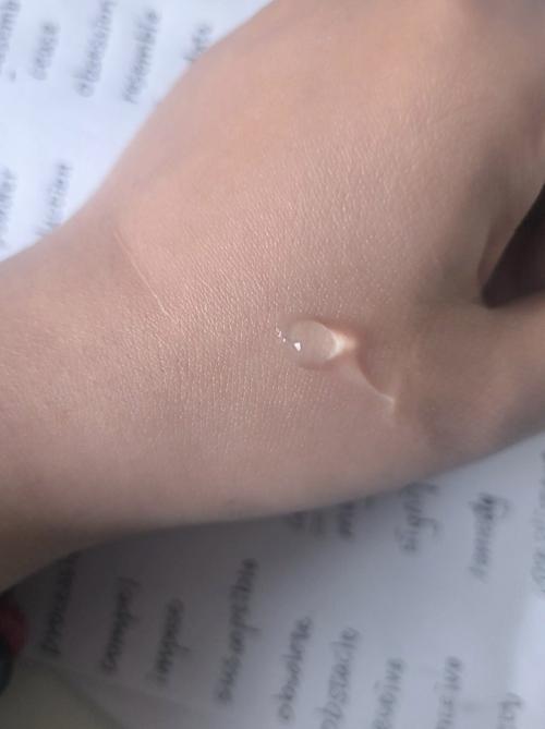 完美芦荟胶祛痘效果真的好吗？-图1