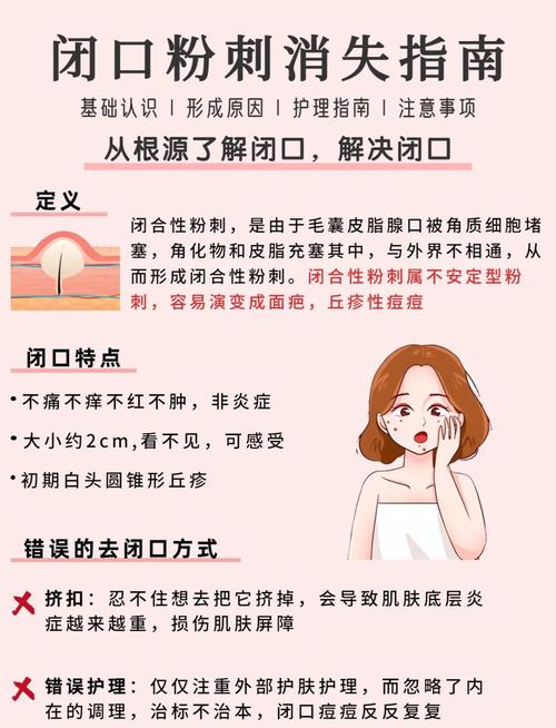 祛痘快的方法有哪些？-图2