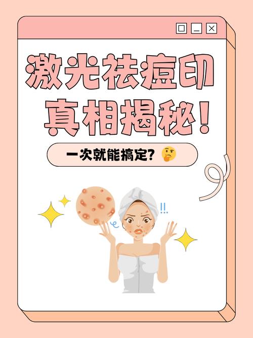 祛痘印光子激光选哪个更好？-图1