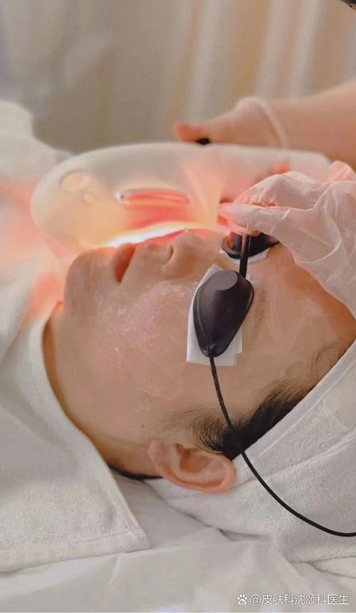 祛痘印光子激光选哪个更好？-图2