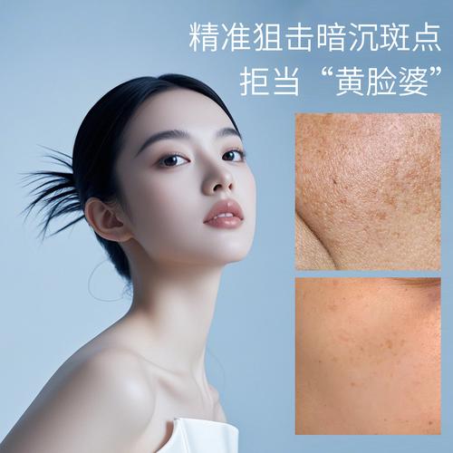 脸上有斑，护肤品怎么选才有效？-图3