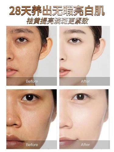 肤色暗沉发黄，护肤品怎么选？-图2