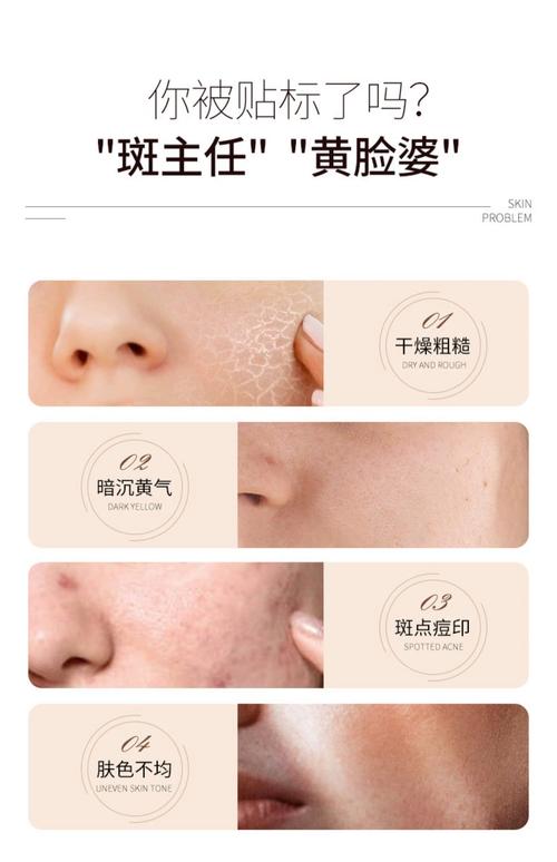 肤色暗沉发黄，护肤品怎么选？-图1