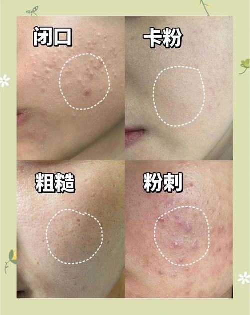 什么护肤品能修复受损角质层？-图3