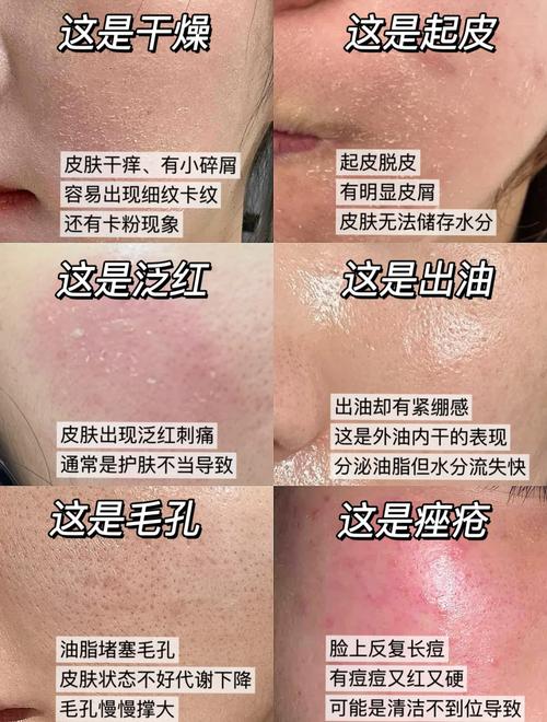 什么护肤品能修复受损角质层？-图2